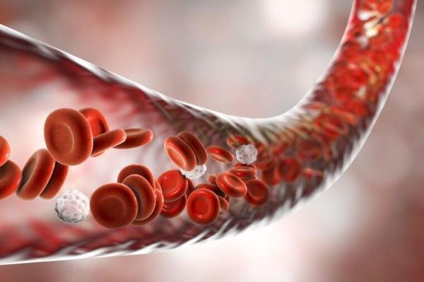 شایع ترین علائم کم خونی چیست؟